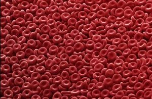 Очищение крови в домашних условиях