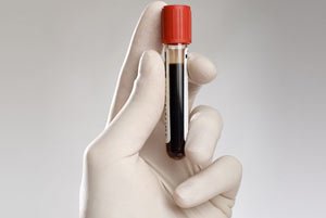 Методы исследования крови