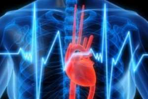 Ишемическая болезнь сердца: причины и симптомы