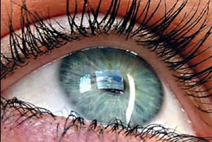Безоперационное лечение катаракты