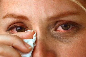 Гонобленнорея - опасное заболевание глаз