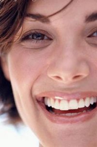 Отбеливание зубов – простой секрет первого впечатления