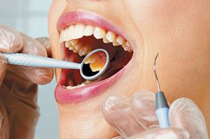 Цистэктомия зуба