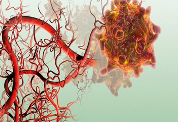 Ученые заглянули внутрь механизма ангиогенеза при метастазах рака легких