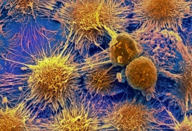 Учеными создана нанокапсула, способная победить рак