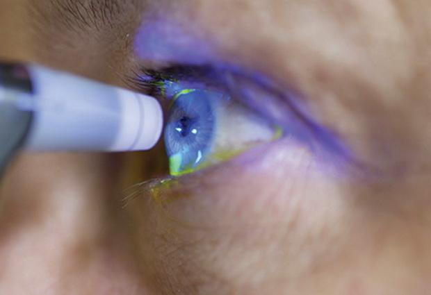 Обнаружено превалирование глаукомы среди людей с апноэ