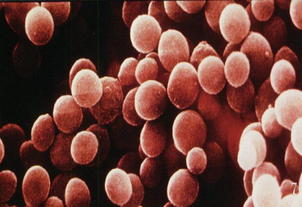 Суперантигены, вырабатываемые стафилококковыми бактериями, являются причиной летального сердечного заболевания