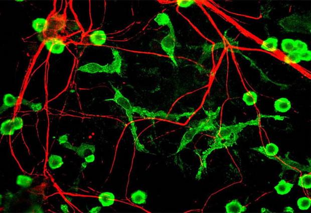 Ученые открыли новый важный сигнал, который направляет развитие головного мозга