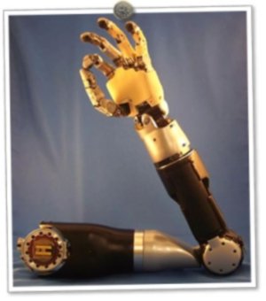 Новая бионическая рука может позволить инвалидам снова чувствовать