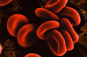 Современная медицина может изменить группу крови
