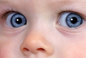 Радиация лечит опухоли глаз у детей