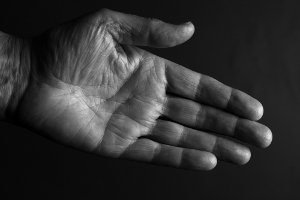 Синдром Дауна можно распознать по линиям на руке