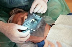 Хирургические операции теперь можно выполнять через полость рта