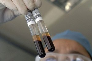 За сдачу анализов австралийцы получат материальное вознаграждение