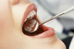 Стоматологические пломбы – что в них опасного?