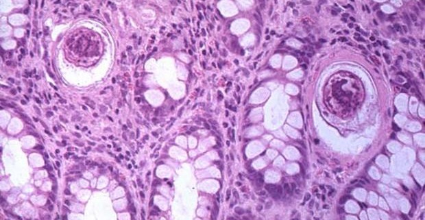Характеристика стволовых клеток личиночной шистосомы может помочь в контроле человеческого паразита