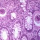 Характеристика стволовых клеток личиночной шистосомы может помочь в контроле человеческого паразита