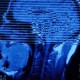 Какое зло таится в мозге: немецкий невропатолог нашел «темное пятно»