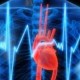 Ишемическая болезнь сердца: причины и симптомы