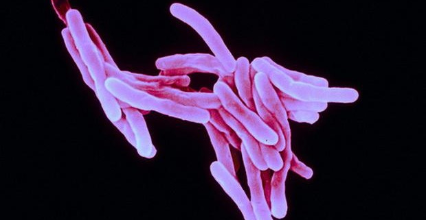 Появилась новая надежда на улучшение лечения туберкулеза