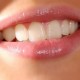 Медики назвали Топ-6 продуктов, разрушающих зубы