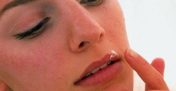 Герпес на губах: не страшен, но неприятен