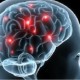 Ученые узнали, как болезнь Альцгеймера «заражает» мозг
