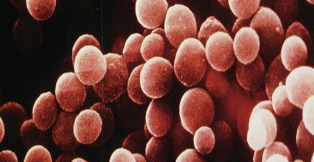 Суперантигены, вырабатываемые стафилококковыми бактериями, являются причиной летального сердечного заболевания