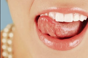 Стоматит полости рта