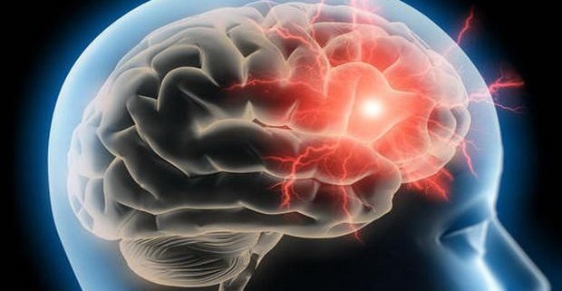 Мигрень может навсегда изменить структуру мозга