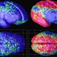 Томография показала, что гены влияют на старение тканей мозга