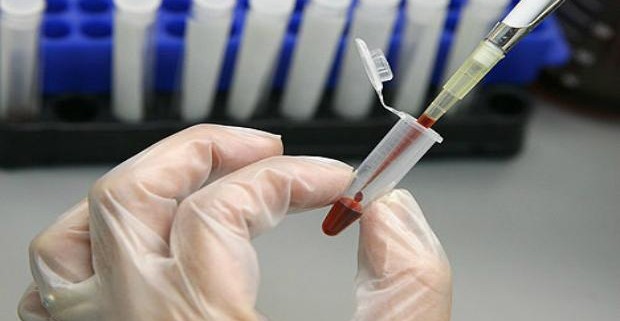 Ученые научились предсказывать смерть по анализу крови