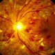 Разработан новый метод лечения ретинопатии с использованием альтернативного ресурса стволовых клеток