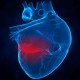 Доказано, что риск умереть от инфаркта повышается ночью и на выходные