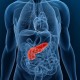 Воспаление поджелудочной железы – панкреатит