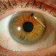 Глаукома: общие понятия, причины, симптомы