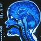 Ученые модернизируют мозг