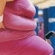 После хирургической потери веса, новые бактерии кишечника спасают от ожирения