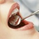 Стоматологические пломбы – что в них опасного?