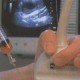 Биопсия хориона — важное исследование во время беременности