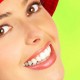 Косметическая реставрация зубов