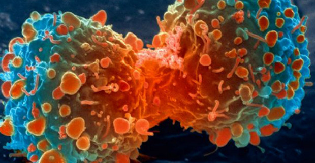 Ученые превратили раковые клетки в иммунные