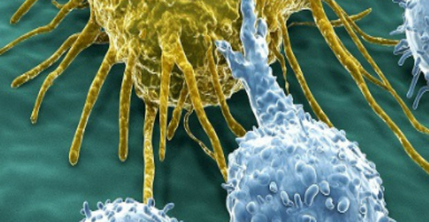 Ученые смогут предсказать рак за 13 лет до проявления симптомов
