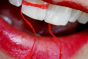 Обычная зубная нить – вред или польза?