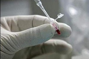 Лабораторные исследования крови с лейкемией