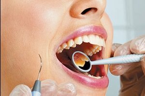 Стоматологический осмотр полости рта