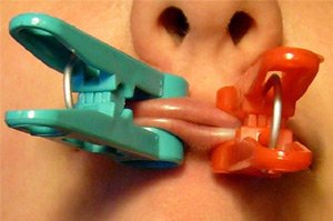 нарушения зубной эмали